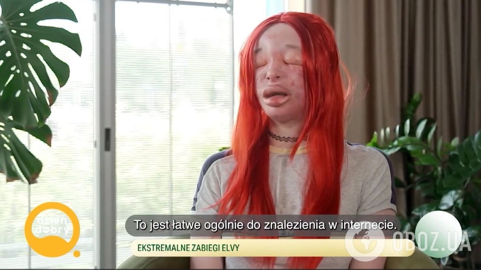 Саморобна пластика силіконом: історія 26-річної трансжінки з Польщі